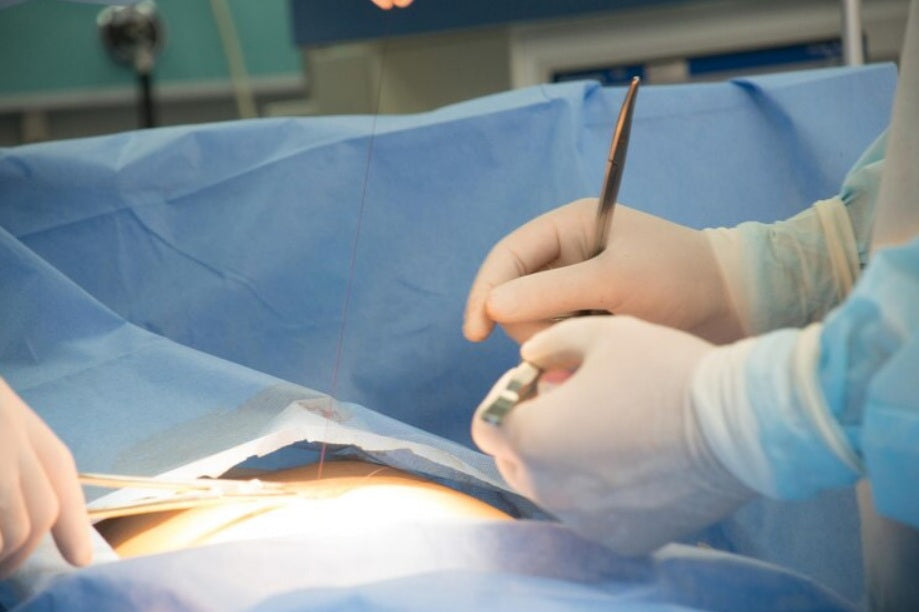 suture