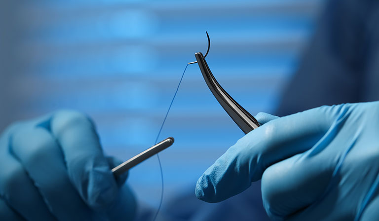 Puncture Indication Systems Can Help Detect Glove Punctures While Suturing