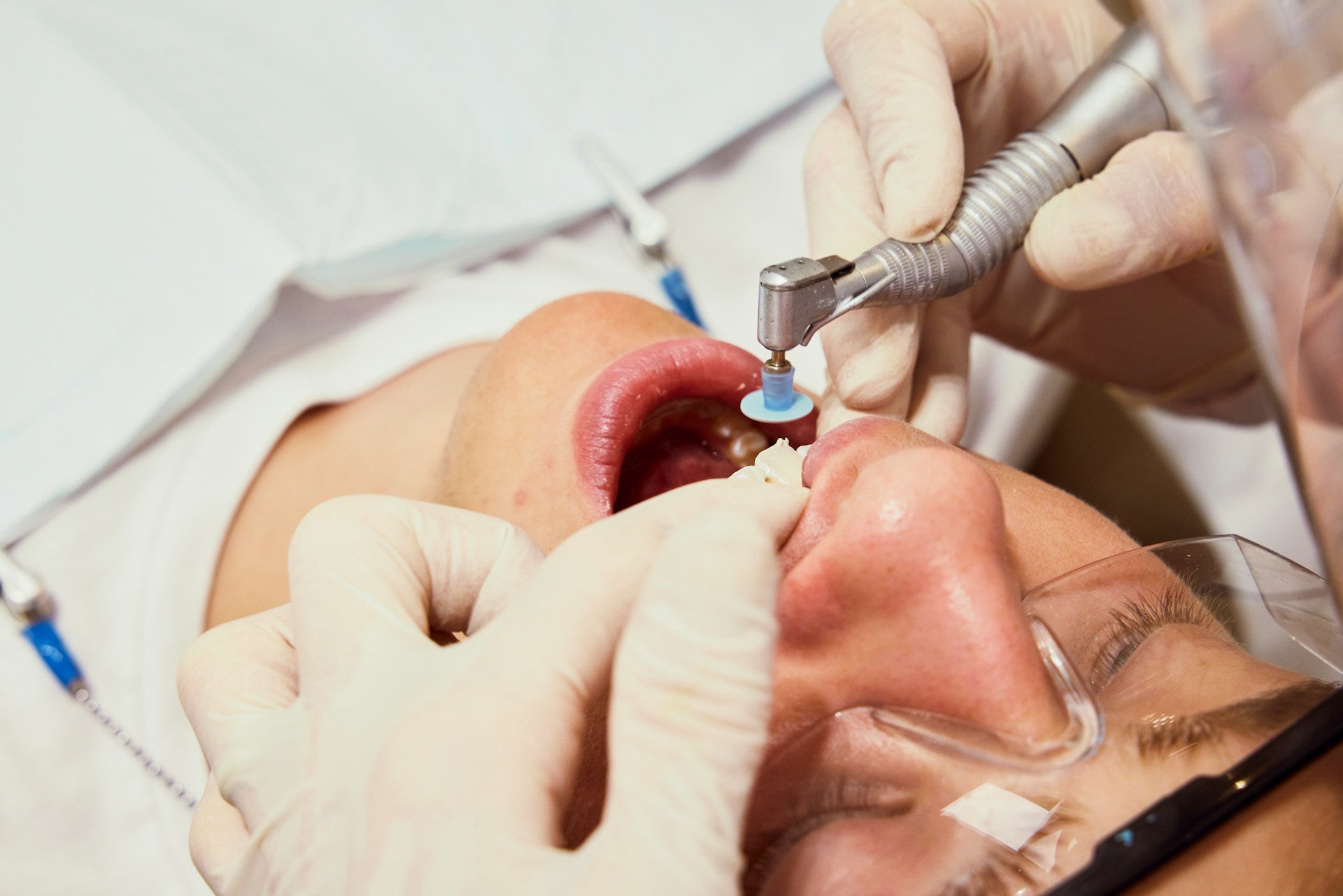 oral surgery
