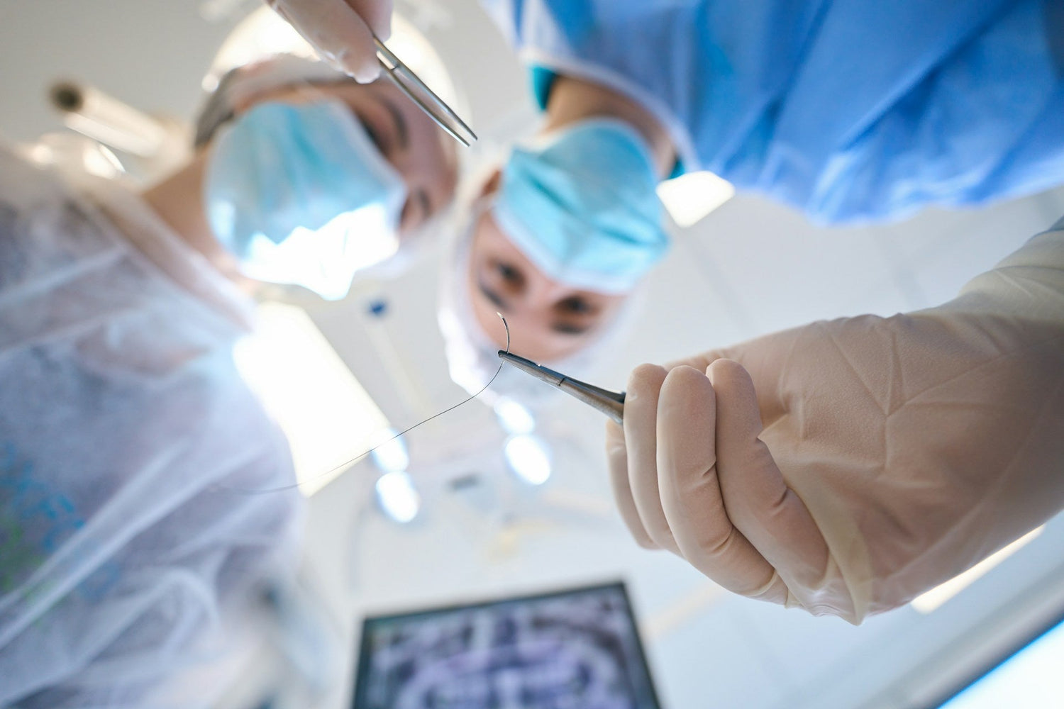 sutures