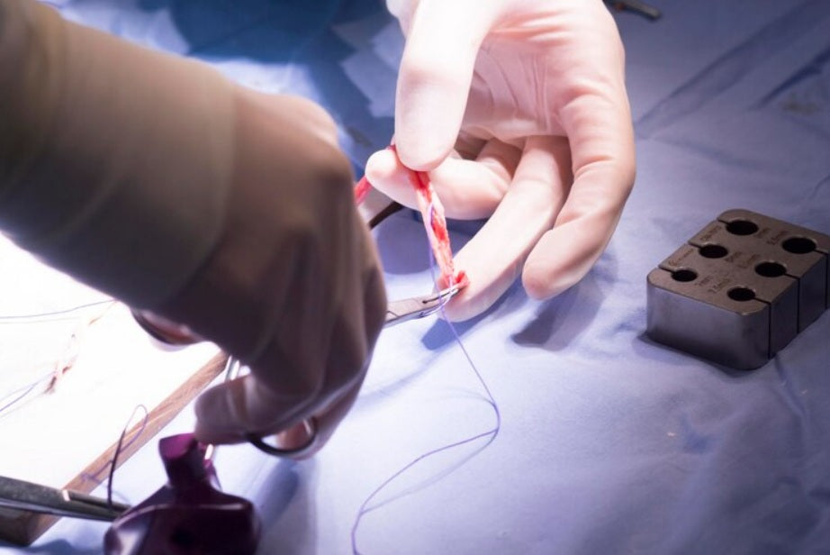 suture